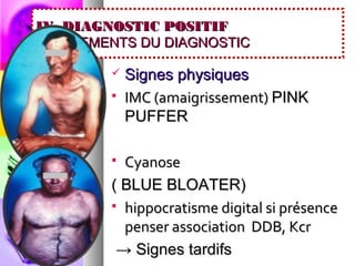 IV. DIAGNOSTIC POSITIF
4.2. ELEMENTS DU DIAGNOSTIC

            Signes physiques
            IMC (amaigrissement) PINK
             PUFFER

          Cyanose
         ( BLUE BLOATER)
          hippocratisme digital si présence
           penser association DDB, Kcr
          → Signes tardifs
 