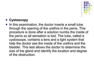 <ul><li>Cystoscopy </li></ul><ul><li>In this examination, the doctor inserts a small tube through the opening of the ureth...