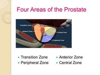 Four Areas of the Prostate




 Transition Zone    Anterior Zone
 Peripheral Zone    Central Zone
 