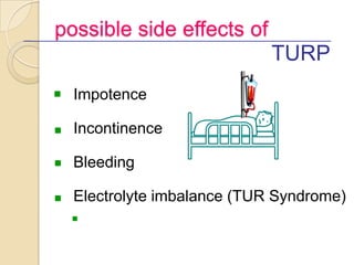 possible side effects of
                              TURP
n   Impotence

n   Incontinence

n   Bleeding

n   Electrolyte...