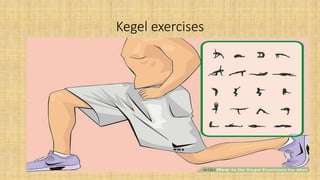 Kegel exercises
 