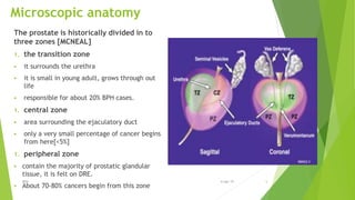 Microscopic anatomy
The prostate is historically divided in to
three zones [MCNEAL]
1. the transition zone
 it surrounds the urethra
 it is small in young adult, grows through out
life
 responsible for about 20% BPH cases.
1. central zone
 area surrounding the ejaculatory duct
 only a very small percentage of cancer begins
from here[<5%]
1. peripheral zone
 contain the majority of prostatic glandular
tissue, it is felt on DRE.
 About 70-80% cancers begin from this zone
BPH 56-Apr-19
 