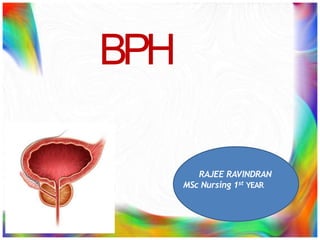Benign Prostate Hyperplasia | PPTX