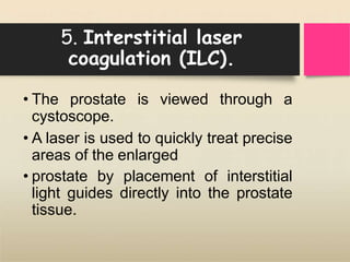 5. Interstitial laser
coagulation (ILC).
• The prostate is viewed through a
cystoscope.
• A laser is used to quickly treat precise
areas of the enlarged
• prostate by placement of interstitial
light guides directly into the prostate
tissue.
 