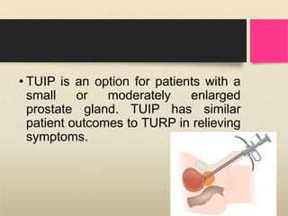 • TUIP is an option for patients with a
small or moderately enlarged
prostate gland. TUIP has similar
patient outcomes to TURP in relieving
symptoms.
 