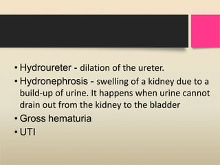 • Hydroureter - dilation of the ureter.
• Hydronephrosis - swelling of a kidney due to a
build-up of urine. It happens when urine cannot
drain out from the kidney to the bladder
• Gross hematuria
• UTI
 