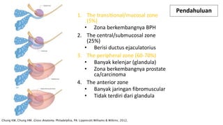 Chung KW, Chung HM. Gross Anatomy. Philadelphia, PA: Lippincott Williams & Wilkins; 2012.
Pendahuluan
1. The transitional/mucosal zone
(5%)
• Zona berkembangnya BPH
2. The central/submucosal zone
(25%)
• Berisi ductus ejaculatorius
3. The peripheral zone (60-70%)
• Banyak kelenjar (glandula)
• Zona berkembangnya prostate
ca/carcinoma
4. The anterior zone
• Banyak jaringan fibromuscular
• Tidak terdiri dari glandula
 