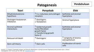 Patogenesis
Teori Penyebab Efek
Dihydrotestosterone
hypothesis
­ 5-a reductase and androgen
receptors
Epithelial and stromal
hyperplasia
Oestrogen-testosteron
imbalance
­ Oestrogens
¯ Testosteron
Stromal hyperplasia
Stromal-epithelial
Interactions
­ Epidermal growth
factor/fibroblast
growth factor
¯ Transforming growth
factor b
Epithelial and stromal
hyperplasia
Reduced cell death ­ Oestrogens ­ Longevity of stroma
and epithelium
Stem cell theory ­ Stem cells Proliferation of transit
cells
Izumi K, Li L, Chang C. Androgen receptor and immune inflammation in benign prostatic hyperplasia and prostate cancer. Clinical
Investigation. 2014; 4(10): pp. 935–950. doi: 10.4155/cli.14.77.
Pendahuluan
 