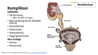 Komplikasi
UROLOGI:
• ISK berulang
• BPH à LUTS à stasis
• Batu kandung kemih (bladder
calculi)
• Divertikel buli
• Hidroureter
• Hidronefrosis
• Gagal ginjal kronis
Non Urologi
• Hernia
• Hemorroid
Manski D, et al. Urologie Online Lehrbuch. http://www.urologielehrbuch.de.
Pendahuluan
 
