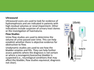 Ultrasound
Ultrasound scans are used to look for evidence of
hydronephrosis and are indicated in patients with
high residual volumes or renal impairment. Other
indications include suspicion of urinary tract stones
or the investigation of haematuria.
Flow Studies
Urine flow studies are used to determine the
volume of urine passed over time. This can help
establish whether there is objective evidence for
obstruction to flow.
Urodynamic studies are used to see how the
bladder empties and fills. They can help further
assess patients where the diagnosis is not certain
or where a neurogenic/overactive bladder is
suspected (i.e., neurological conditions that may
affect the bladder, flow studies equivocal, diagnosis
not clear).
 
