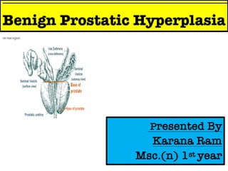 Benign Prostatic Hyperplasia
Presented By
Karana Ram
Msc.(n) 1st year
 