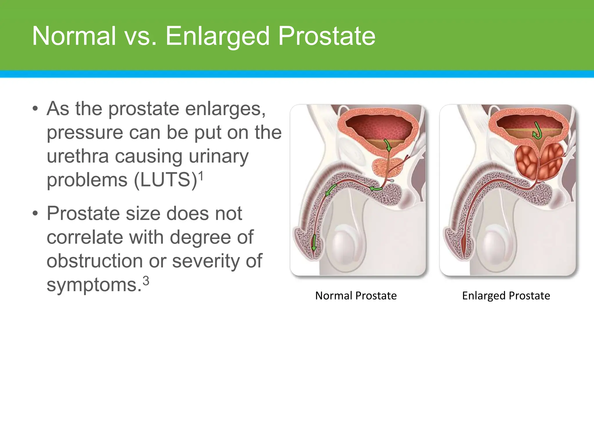 UNDERSTANDING THE PROSTATE visual data 8