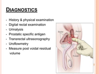 Benign Prostatic Hyperplasia by Dr Ravi Meena | PPT