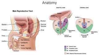 Management of benign prostatic hyperplasia.pptx