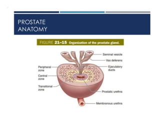 BPH or NODULAR HYPERPLASIA of Prostate BPH.pptx