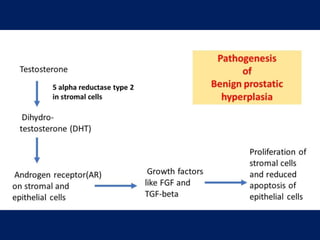 Comprehensive Overview of Benign Prostate Hyperplasia: Anatomy ...