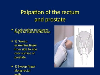comprehensive-overview-of-benign-prostate-hyperplasia-anatomy
