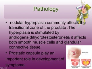 Pathology

• nodular hyperplasia commonly affects the
  transitional zone of the prostate .The
  hyperplasia is stimulated by
  androgens(dihydrotestosterone)& it affects
  both smooth muscle cells and glandular
  connective tissue.
• Prostatic capsule play an
Important role in development of
symptome.
 