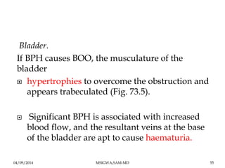 Bladder. 
If BPH causes BOO, the musculature of the 
bladder 
 hypertrophies to overcome the obstruction and 
appears tra...