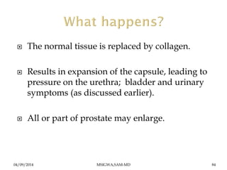  The normal tissue is replaced by collagen. 
 Results in expansion of the capsule, leading to 
pressure on the urethra; ...