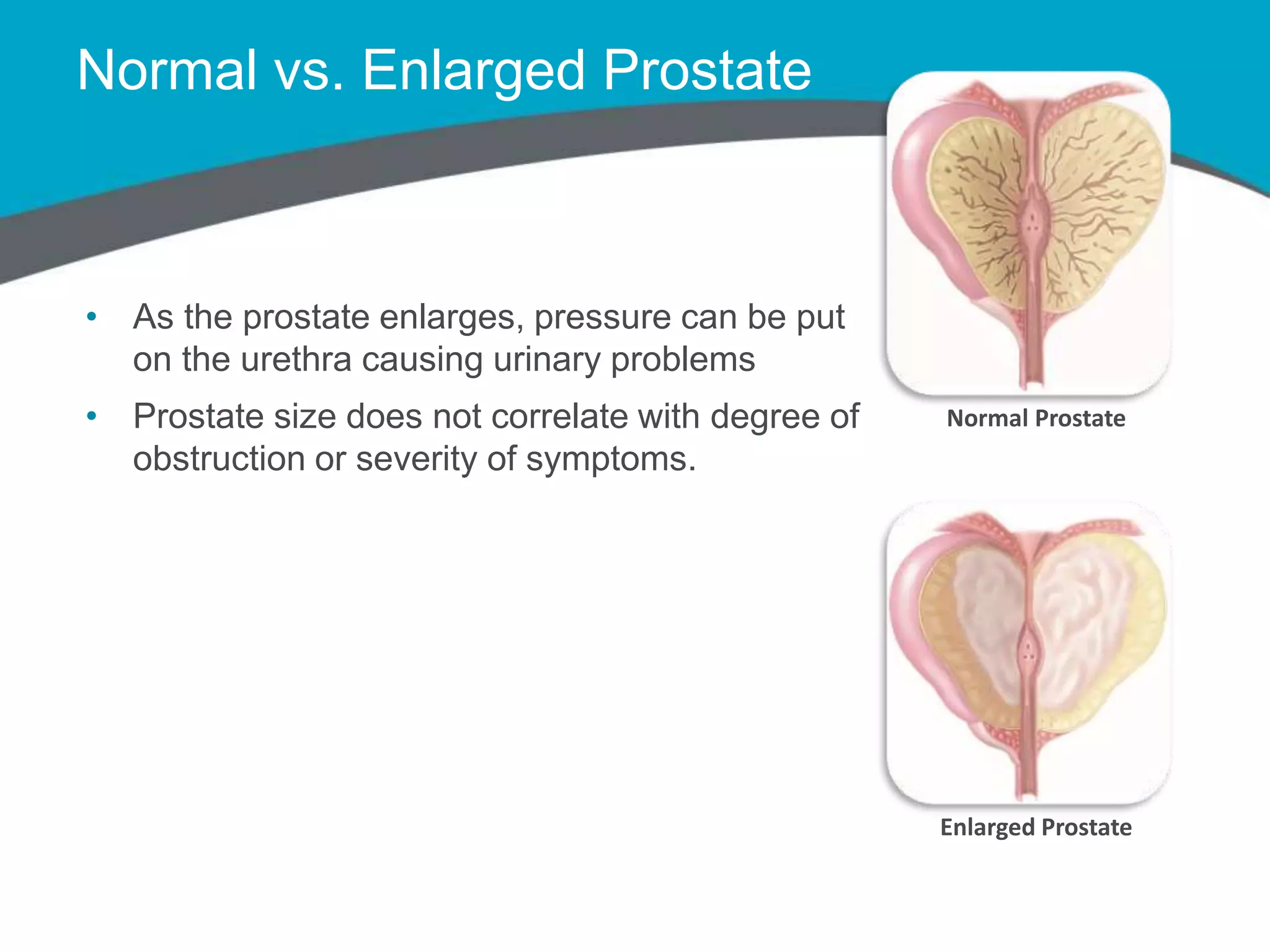 Prostate visual data 8