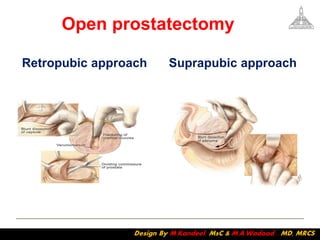 Transpubic Approach BPH | PDF