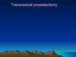 Transvesical prostatectomy 