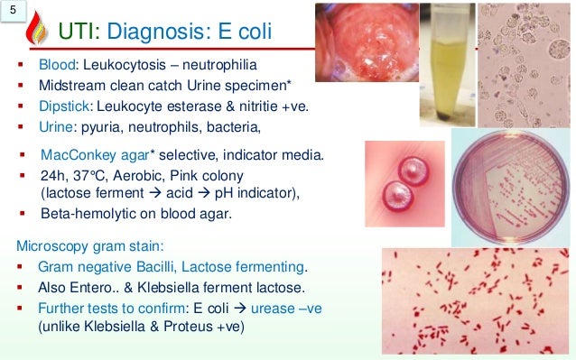 Pathology of Urinary Tract Infectionws