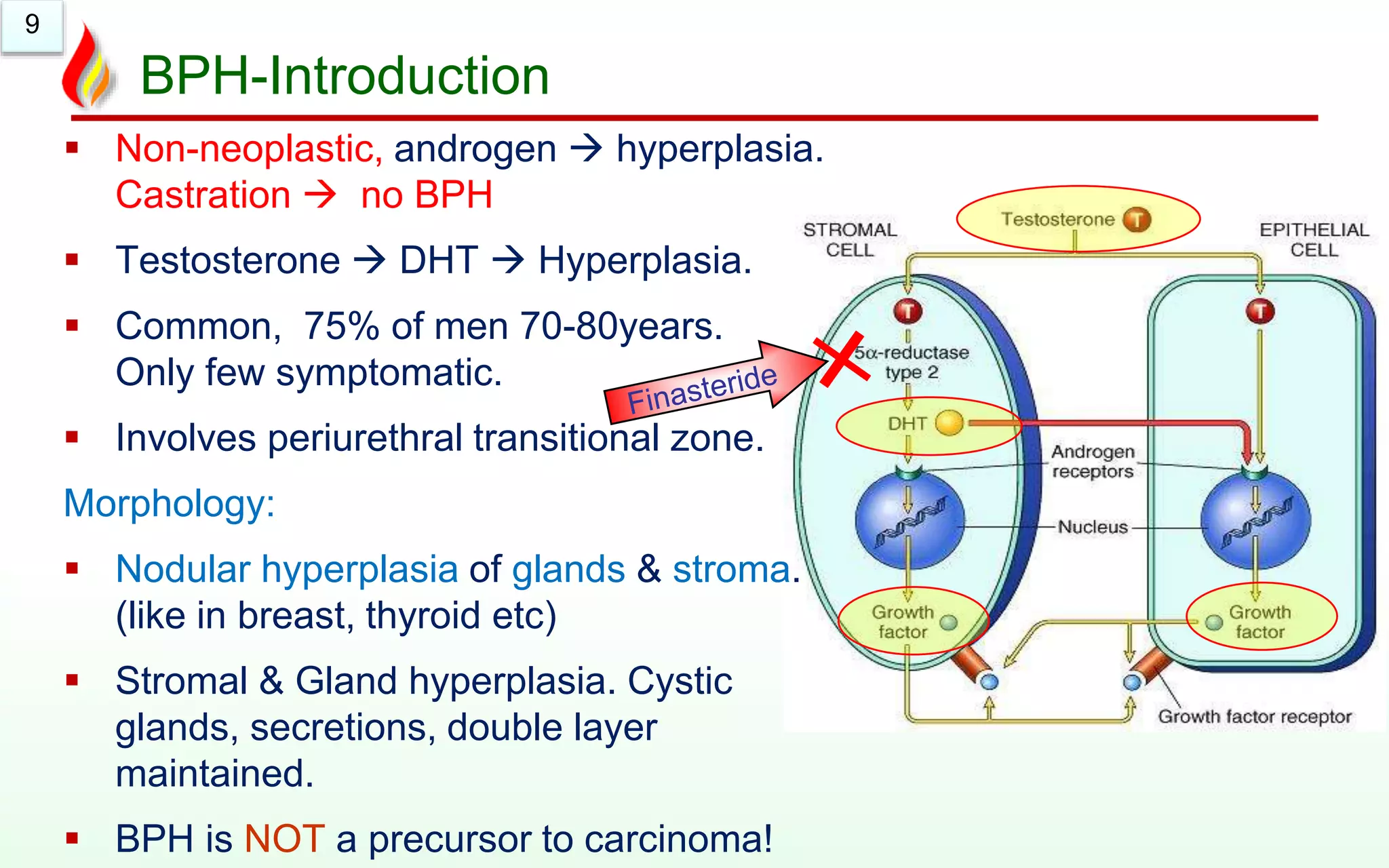 9
BPH-Introduction
 Non-neoplastic, androgen  hyperplasia.
Castration  no BPH
 Testosterone  DHT  Hyperplasia.
 Common, 75% of men 70-80years.
Only few symptomatic.
 Involves periurethral transitional zone.
Morphology:
 Nodular hyperplasia of glands & stroma.
(like in breast, thyroid etc)
 Stromal & Gland hyperplasia. Cystic
glands, secretions, double layer
maintained.
 BPH is NOT a precursor to carcinoma!
 
