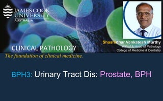 CLINICAL PATHOLOGY
The foundation of clinical medicine.
Shashidhar Venkatesh Murthy
A/Prof & Head of Pathology
College of Medicine & Dentistry
BPH3: Urinary Tract Dis: Prostate, BPH
 