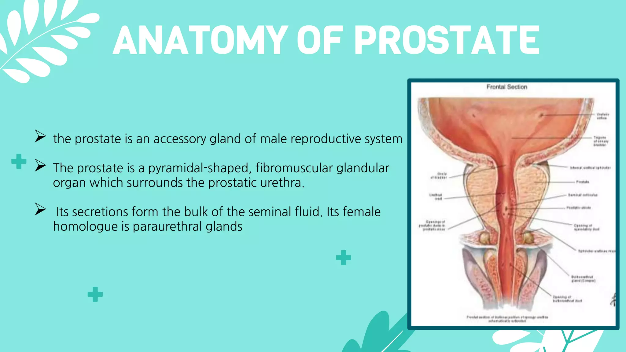 benign prostatic hyperplasia and carcinoma.pptx