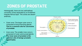 ZONES OF PROSTATE
Histologically, there are two well-defined
concentric zones separated by an ill-defined
irregular fibrou...