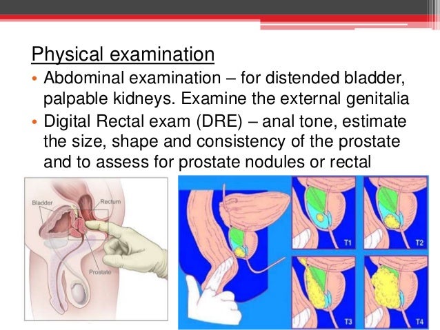 Benign Prostatic Hypertrophy, Prostatitis and Hematuria