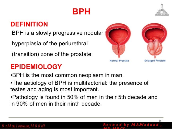 BPH and Obstructive Uropathy