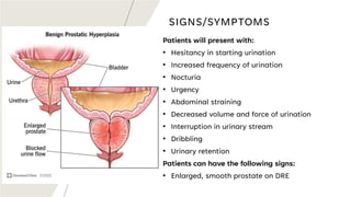 High Riding Prostate Sign Benign Prostatic Hyperplasia and Urethral Strictures - Epidiemiology ...