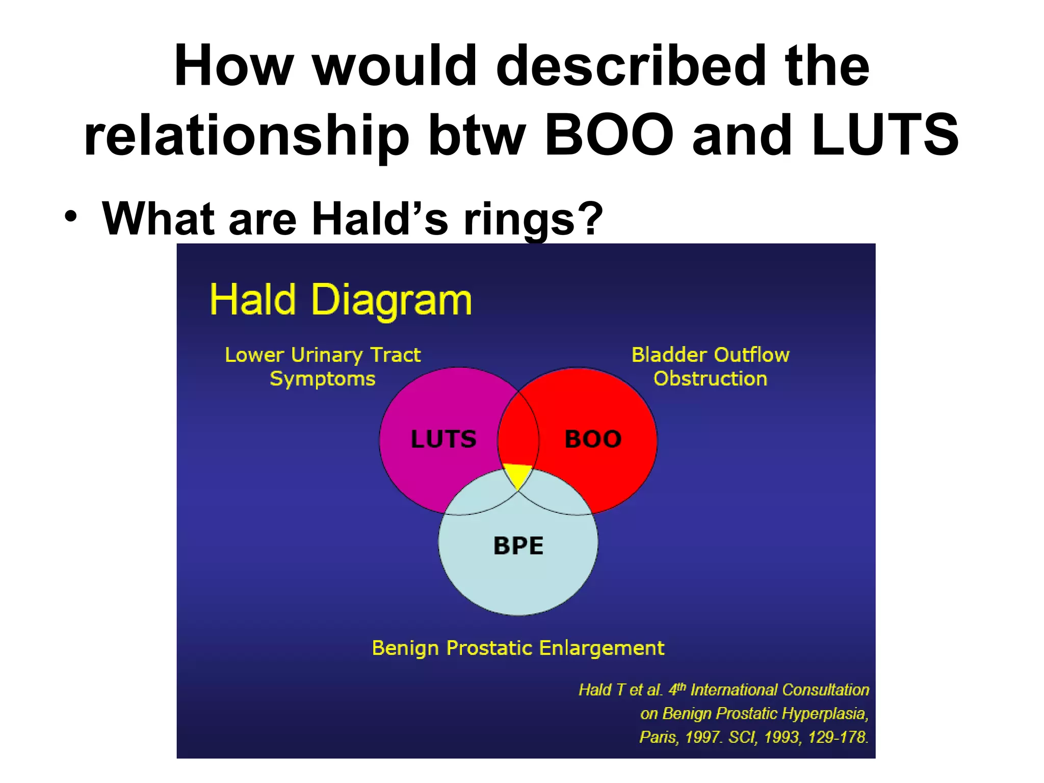 16
How would described the
relationship btw BOO and LUTS
• What are Hald’s rings?
 