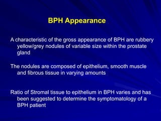 Benign prostatic hyperplasia by Sayed Eleweedy | PPT