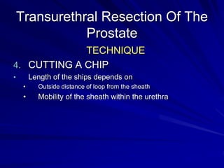 Transurethral Resection Of The
Prostate
TECHNIQUE
4. BLADDER NECK RESECTION
 Trilobar hypertrophy
 Allows floating back ...