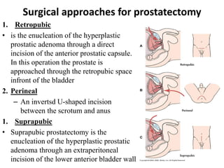 Surgical approaches for prostatectomy
1. Retropubic
• is the enucleation of the hyperplastic
prostatic adenoma through a direct
incision of the anterior prostatic capsule.
In this operation the prostate is
approached through the retropubic space
infront of the bladder
2. Perineal
– An invertsd U-shaped incision
between the scrotum and anus
1. Suprapubic
• Suprapubic prostatectomy is the
enucleation of the hyperplastic prostatic
adenoma through an extraperitoneal
incision of the lower anterior bladder wall
 