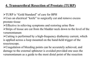 4. Transurethral Resection of Prostate (TURP)
TURP is “Gold Standard” of care for BPH
Uses an electrical “knife” to surg...