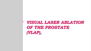 VISUAL LASER ABLATION
OF THE PROSTATE
(VLAP),
 