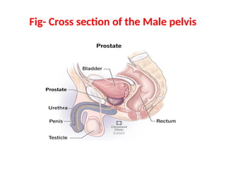 Fig- Cross section of the Male pelvis
 