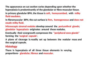 The appearance on cut section varies depending upon whether the
hyperplasia is predominantly of the glandular or fibro-muscular tissue.
In primary glandular BPH, the tissue is soft, honeycombed, with milky
fluid exudates.
In fibromuscular BPH, the cut surface is firm, homogeneous and does not
exude milky fluid.
Microscopic stromal nodules develop around the periurethral glands;
glandular hyperplasia originates around these nodules.
Eventually their overgrowth compresses the “peripheral zone glands”
forming the ‘surgical capsule’.
A plane of cleavage is readily set up between the nodular mass and
the surgical capsule.
Histology
There is hyperplasia of all three tissue elements in varying
proportions- glandular, fibrous and muscular.
 