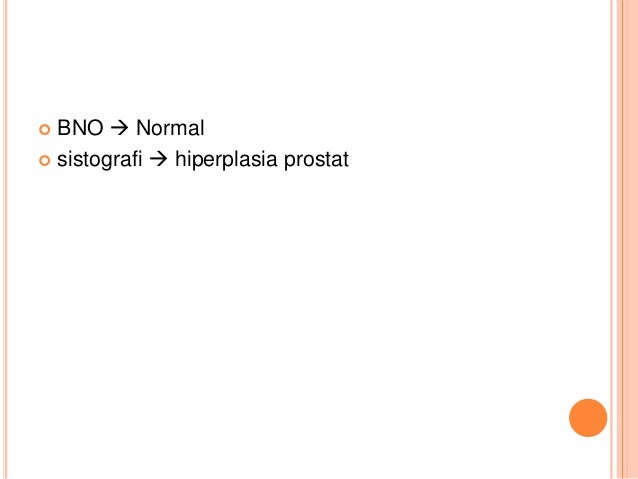 BPH ppt