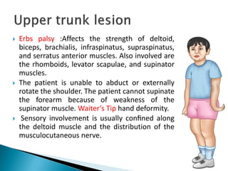  Erbs palsy :Affects the strength of deltoid,
biceps, brachialis, infraspinatus, supraspinatus,
and serratus anterior muscles. Also involved are
the rhomboids, levator scapulae, and supinator
muscles.
 The patient is unable to abduct or externally
rotate the shoulder. The patient cannot supinate
the forearm because of weakness of the
supinator muscle. Waiter’s Tip hand deformity.
 Sensory involvement is usually conﬁned along
the deltoid muscle and the distribution of the
musculocutaneous nerve.
 