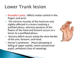  Klumpke’s palsy : Affects motor control in the
ﬁngers and wrist.
 The intrinsic muscles of the hand are only
slightly affected in a lesion involving a
preﬁxed plexus, whereas paralysis of the
ﬂexors of the hand and forearm occurs in a
lesion to a postﬁxed plexus.
 Sensory deﬁcit occurs along the ulnar border
of the arm, forearm, and hand.
 Horner’s syndrome : Ptosis (drooping or
falling of upper eyelid), miosis (constricted
pupil) ,anhidrosis (loss of sweating)
 