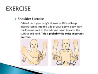  Shoulder Exercise
C-Bend both your baby’s elbows to 90° and keep
elbows tucked into the side of your baby’s body. Turn
the forearms out to the side and down towards the
surface and hold. This is probably the most important
exercise.
 