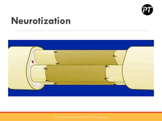 BRACHIAL PLEXUS INJURY - Dr Rohit Bhaskar | PDF