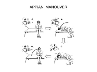 APPIANI MANOUVER

 