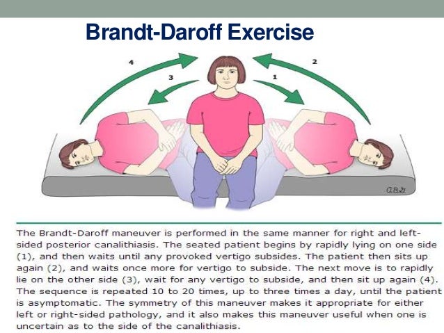 Benign Paroxysmal Positional Vertigo Exercises PXNZ Benign Paroxysmal Positional Vertigo Exercises PXNZ